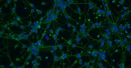 Fluoreszenzmikroskopische Aufnahme von menschlichen Neuronen; grün: das neuronale Netzwerk, blau: die Zellkerne. | Foto: Tanja Schwerdtle.