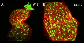 Konfokalmikroskopische Aufnahme des Herzens eines Zebrafischembryos. Der Verlust eines bestimmten Proteins führt zu einer ballonartigen Vergrößerung des Herzschlauchs (rechts). Fotos: Salim Seyfried und Marc Renz.