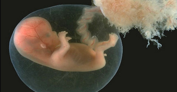 Bild: Berthold Hocher Bild: Berthold Hocher