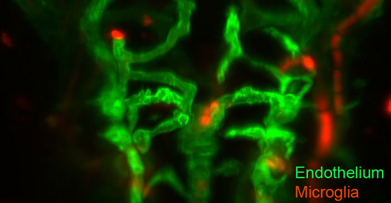 Zerebrale Blutgefäße des Zebrafischembryos am zweiten Tag der Normalentwicklung Foto: Brent Derry