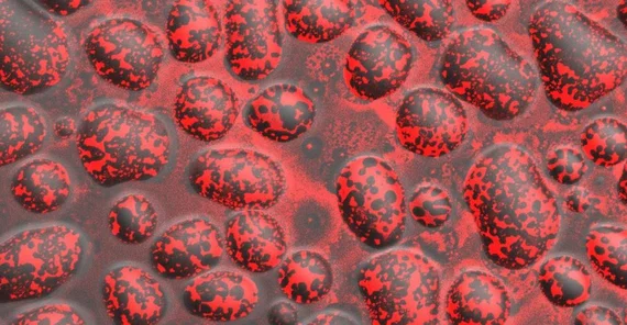 Mikroskopisch kleine Wassertropfen, die mit einer Schicht Lecithine überzogen sind. (Foto: Max-Planck-Institut für Kolloid- und Grenzflächenforschung/Roland Knorr)