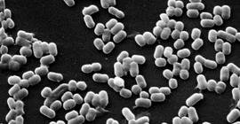 A look through the microscope shows the structure of bacteria inhibiting the human intestine. Photo: Prof. Dr. Michael Blaut.