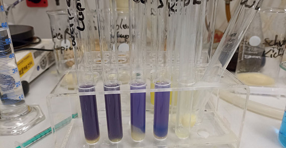 Beim Biuret-Nachweis zeigt die Verfärbung an, dass Proteine enthalten sind. Beim Biuret-Nachweis zeigt die Verfärbung an, dass Proteine enthalten sind.