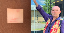 Ruppe Koselleck mit einer Arbeit zum Thema „Haut“ von Studentin Elisabeth Riesenhuber an der Rostfassade des Inklusionsgebäudes Haus 31 auf dem Uni-Campus Golm | Foto: A. Horn-Conrad